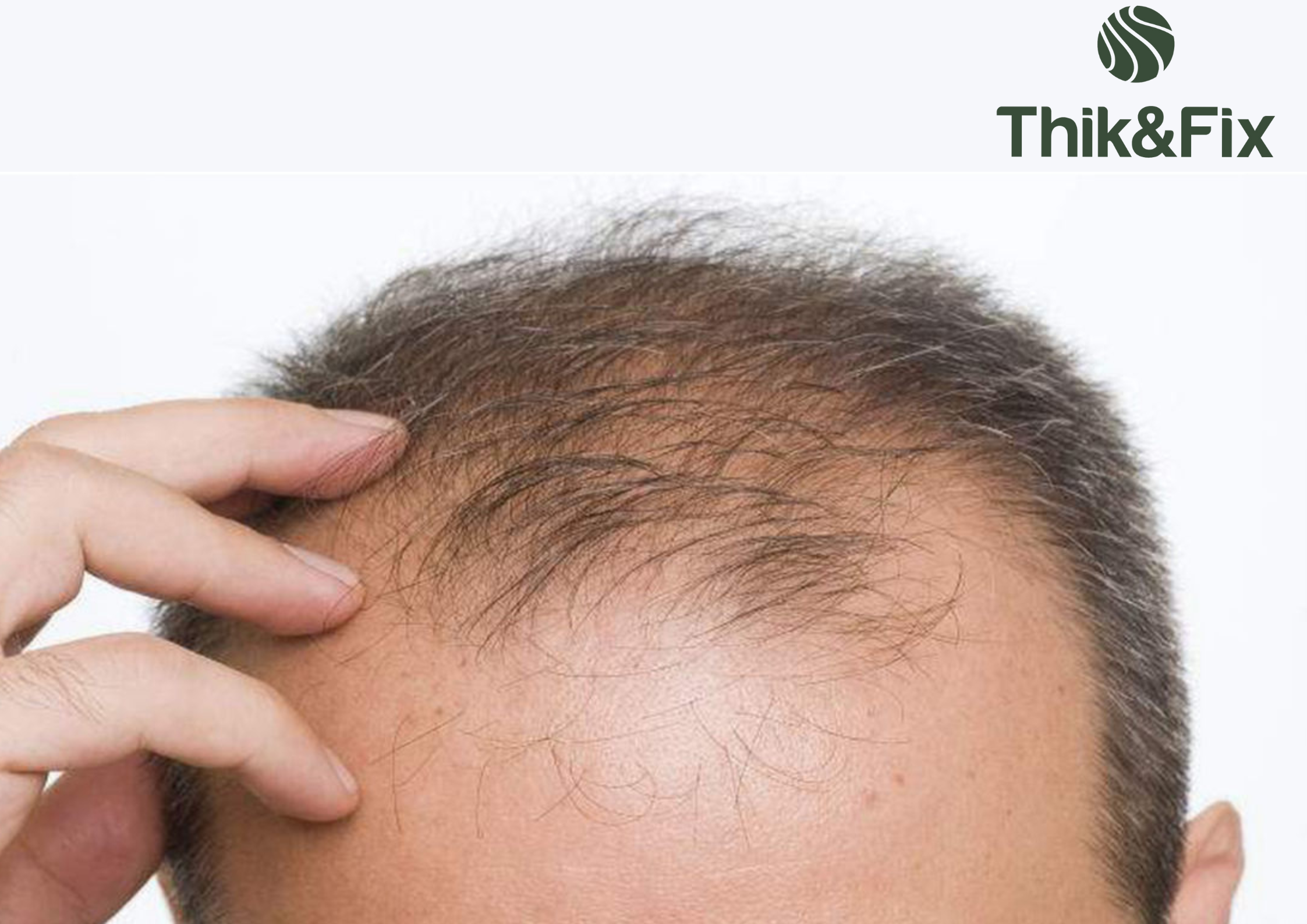 Làm thế nào và cách chống rụng tóc nam