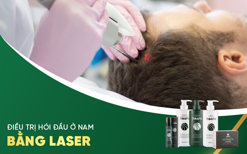 điều trị hói đầu ở nam bằng laser